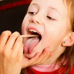 舌を検査される少女