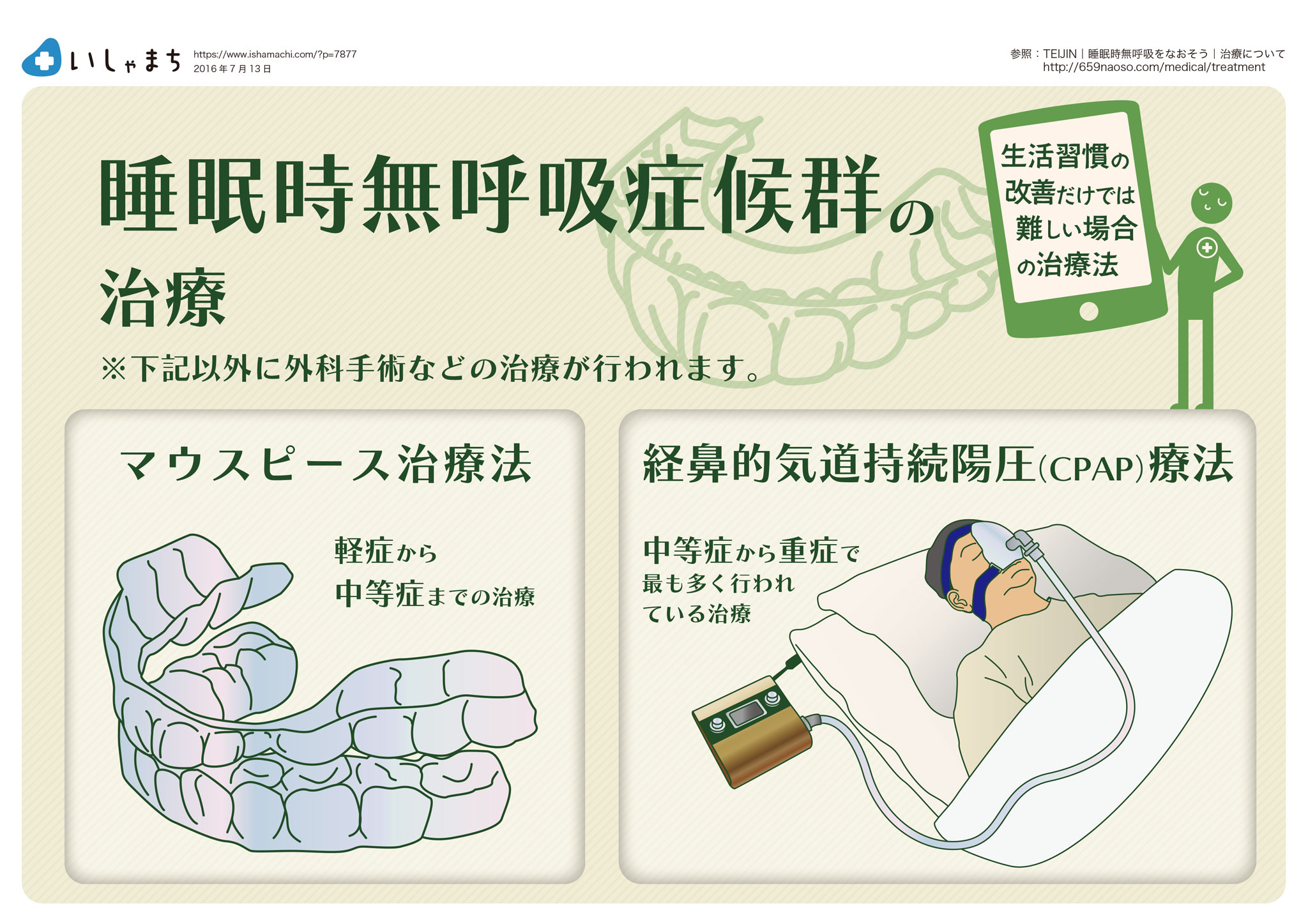 睡眠時無呼吸症候群の治療-マウスピース-CPAP-図解