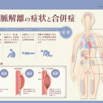 大動脈解離の症状と合併症