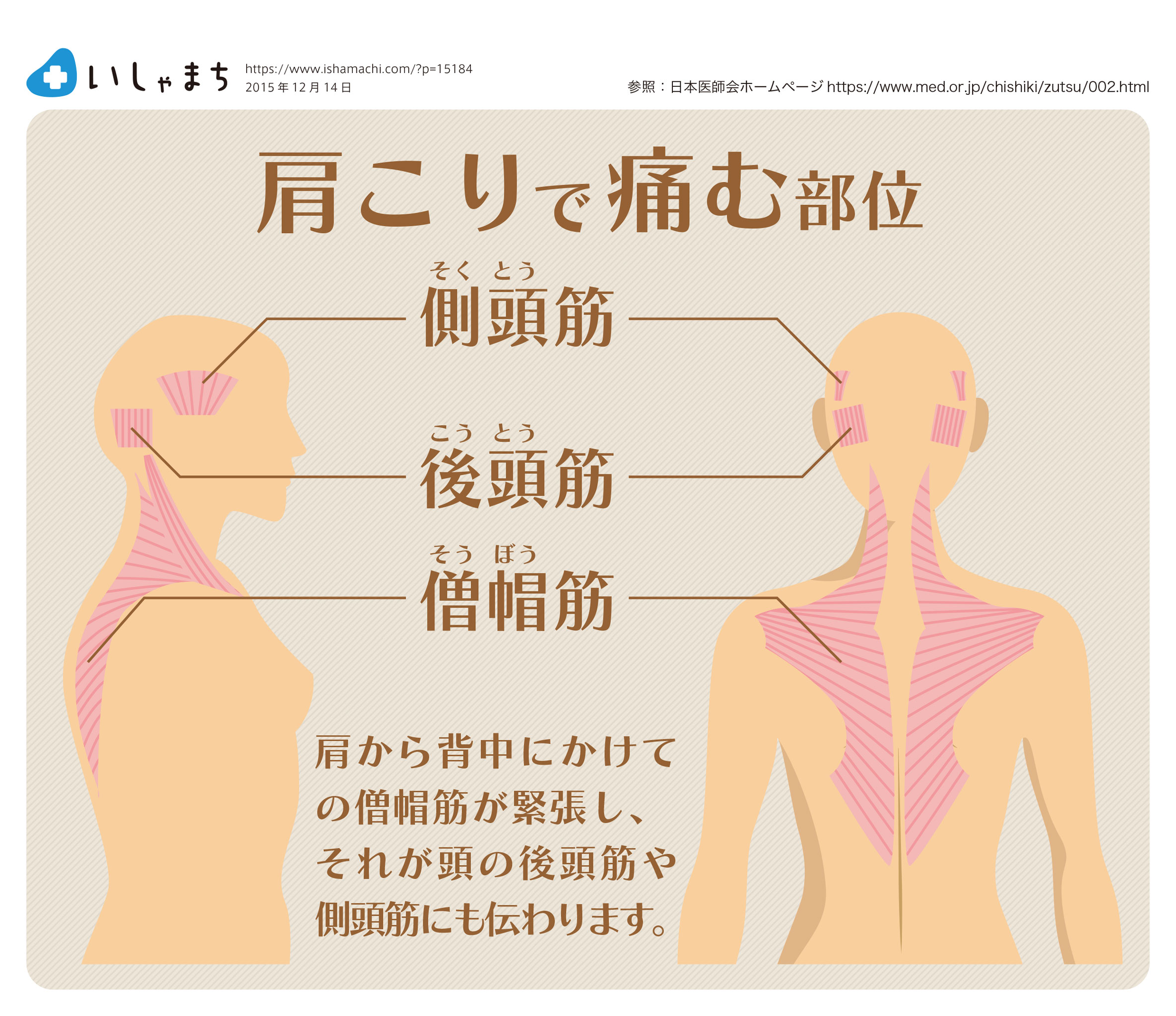 背中が痛む 痛む場所ごとに図で見る14の原因 肩こり それとも他の病気 いしゃまち