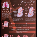 気胸の症状とメカニズム