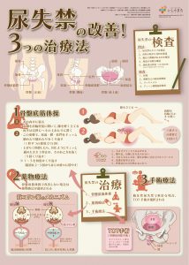 尿失禁を改善する3つの治療法-図解