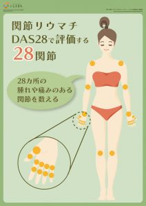 関節リウマチ DAS28で評価する28関節