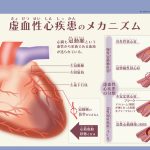 虚血性心疾患のメカニズム