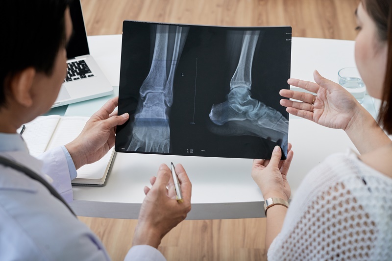 足のレントゲン画像を見ながら医師の説明を受ける女性
