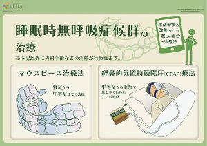 マウスピース療法/経鼻的気道持続陽圧（CPAP）療法