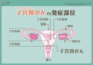 子宮頸がんの発症率