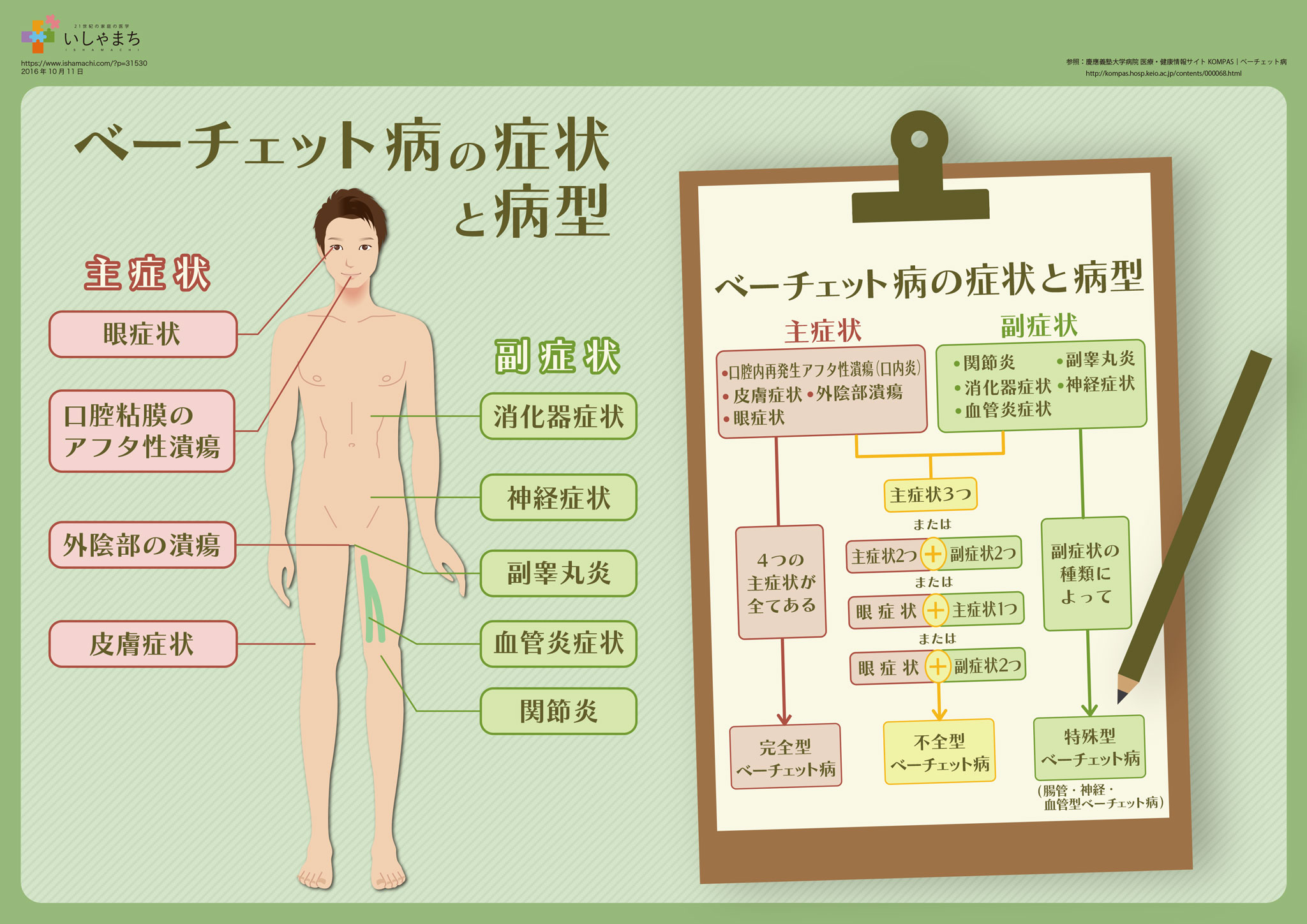 ベーチェット病の病状と病型