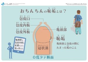 おちんちんの恥垢とは-図解