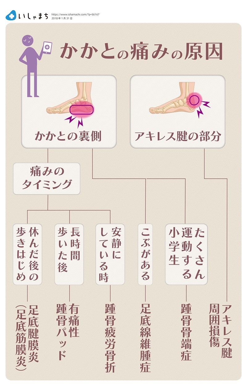 かかとが痛い 病院に行くべき 原因は いしゃまち