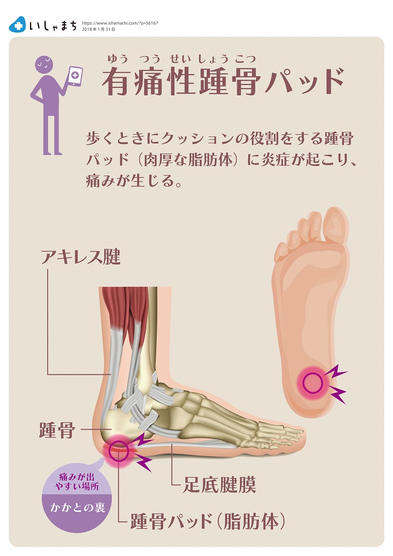 かかと 打撲 歩く と 痛い