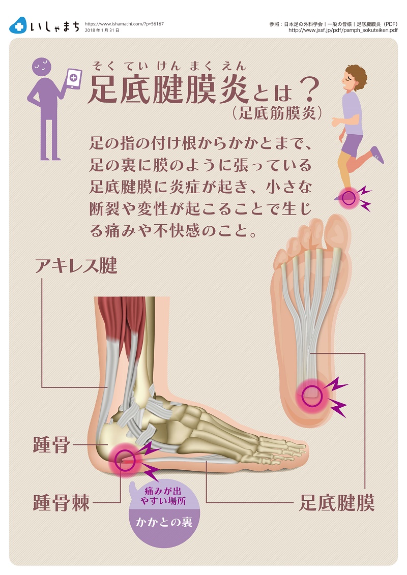 かかとが痛い 病院に行くべき 原因は いしゃまち