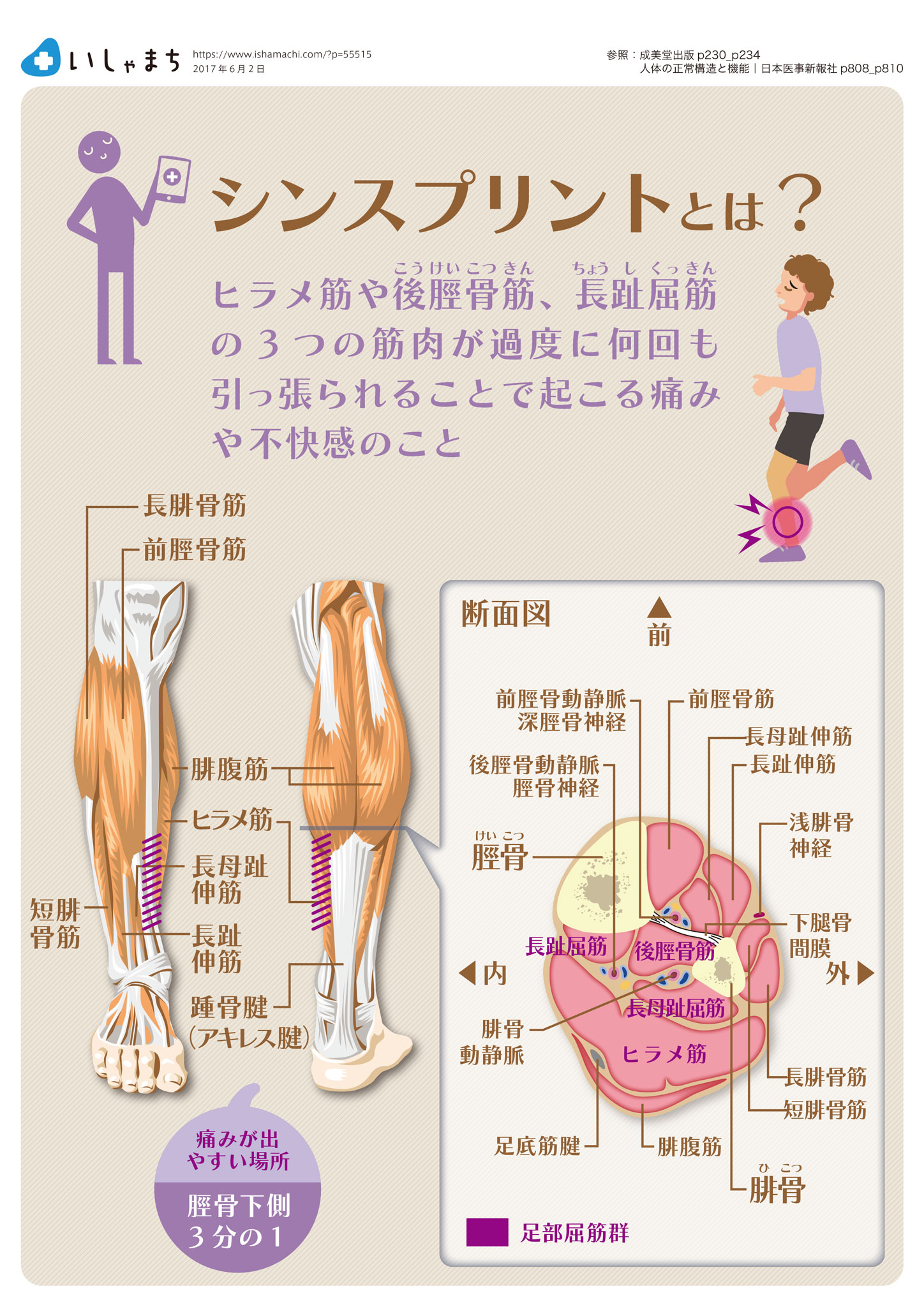 シンスプリントとは-図解