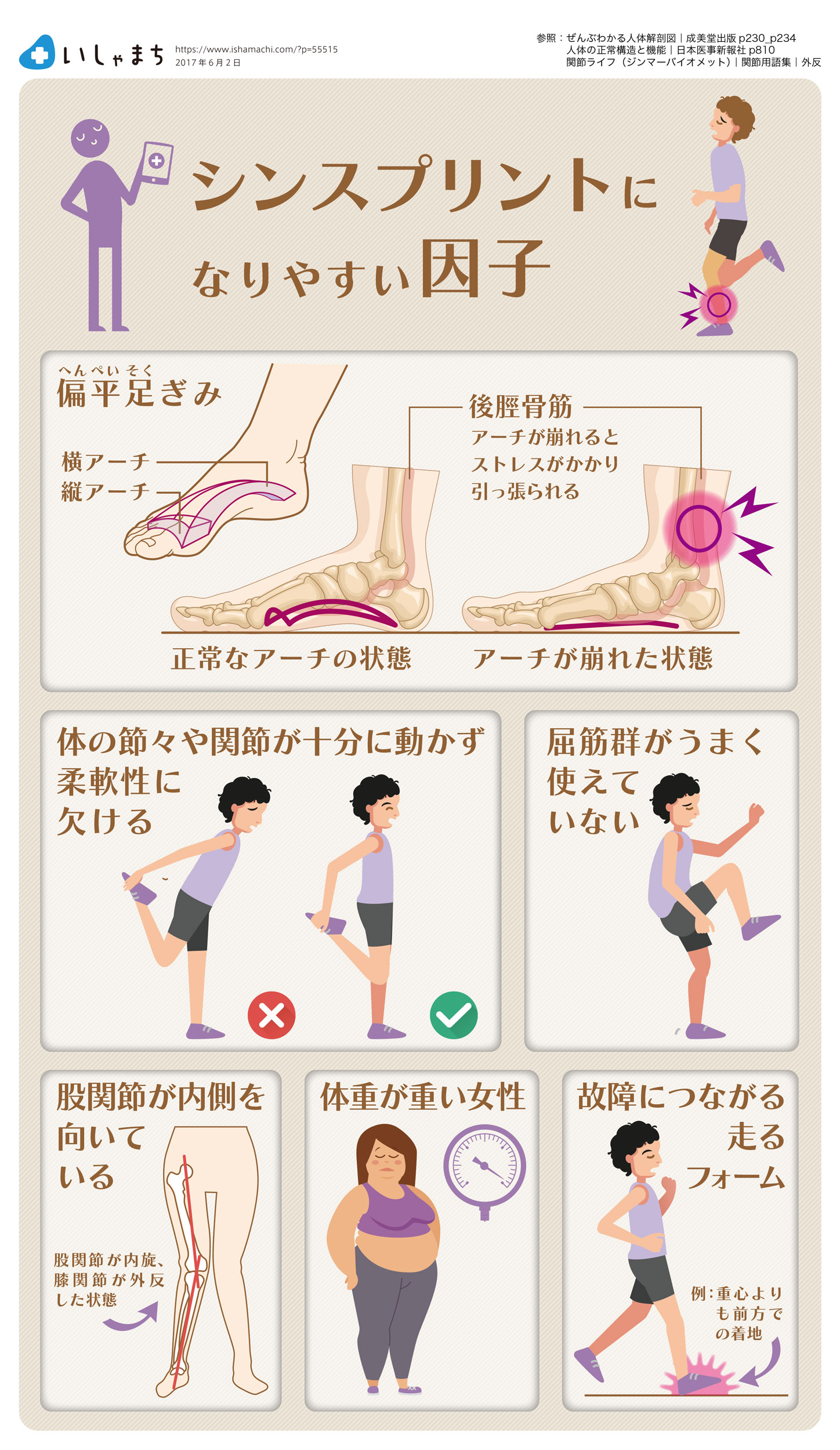 シンスプリントになりやすい因子-図解