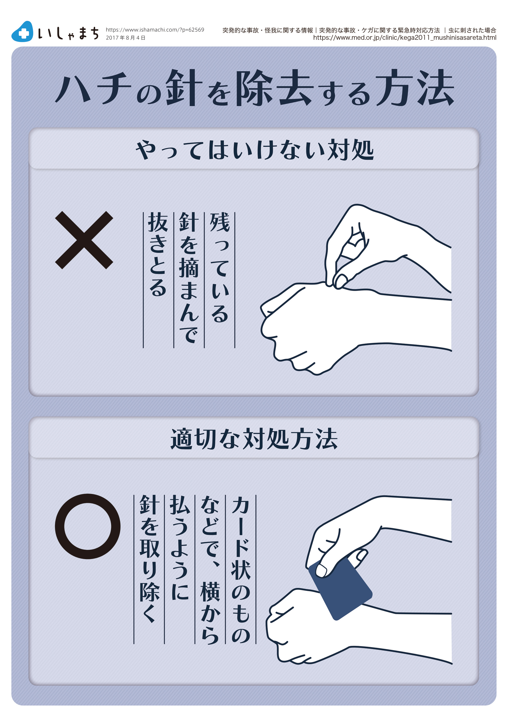 ハチの針を除去する方法-図解